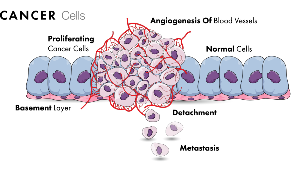 cancer treatment, cancer immunotherapy, mechanism of cancer, what is cancer, immunotherapy for cancer, treatment for cancer,