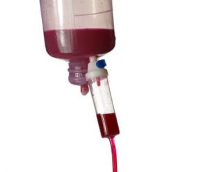 blood-infusion-iv-ozone-therapy (1)
