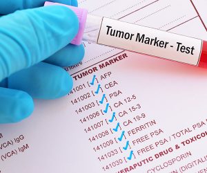 cancer-biomarker-test